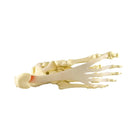 Modelo de fascitis plantar – Pie/Tobillo