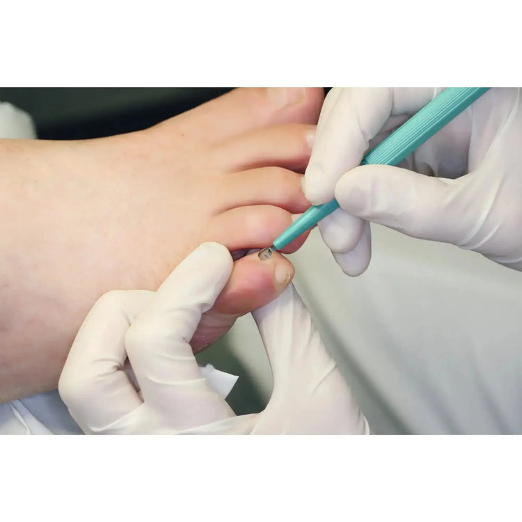 Cureta cutánea - Largo: 15 cm - Ruck Ruck 