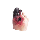 Modèle de pied diabétique avec plaie - Life form