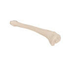 Tibia - Anatomía y patología